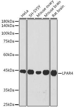 LPAR4 Rabbit Polyclonal Antibody