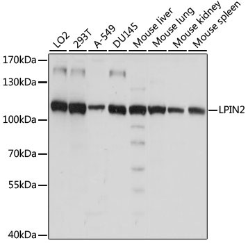 LPIN2 Rabbit Polyclonal Antibody