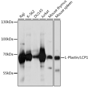 L-Plastin/LCP1 Rabbit Polyclonal Antibody