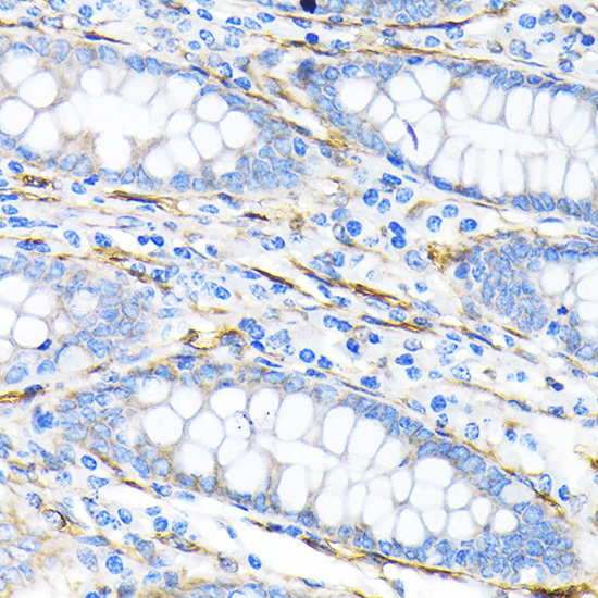 LPP Rabbit Monoclonal Antibody - Image 2