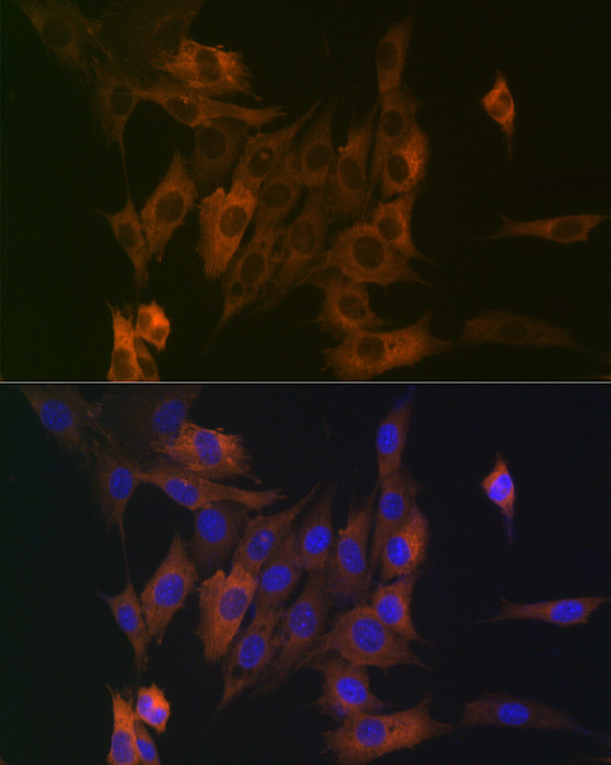 LPP Rabbit Monoclonal Antibody - Image 3