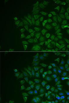 LRAT Rabbit Polyclonal Antibody - Image 2