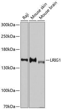 LRIG1 Rabbit Polyclonal Antibody
