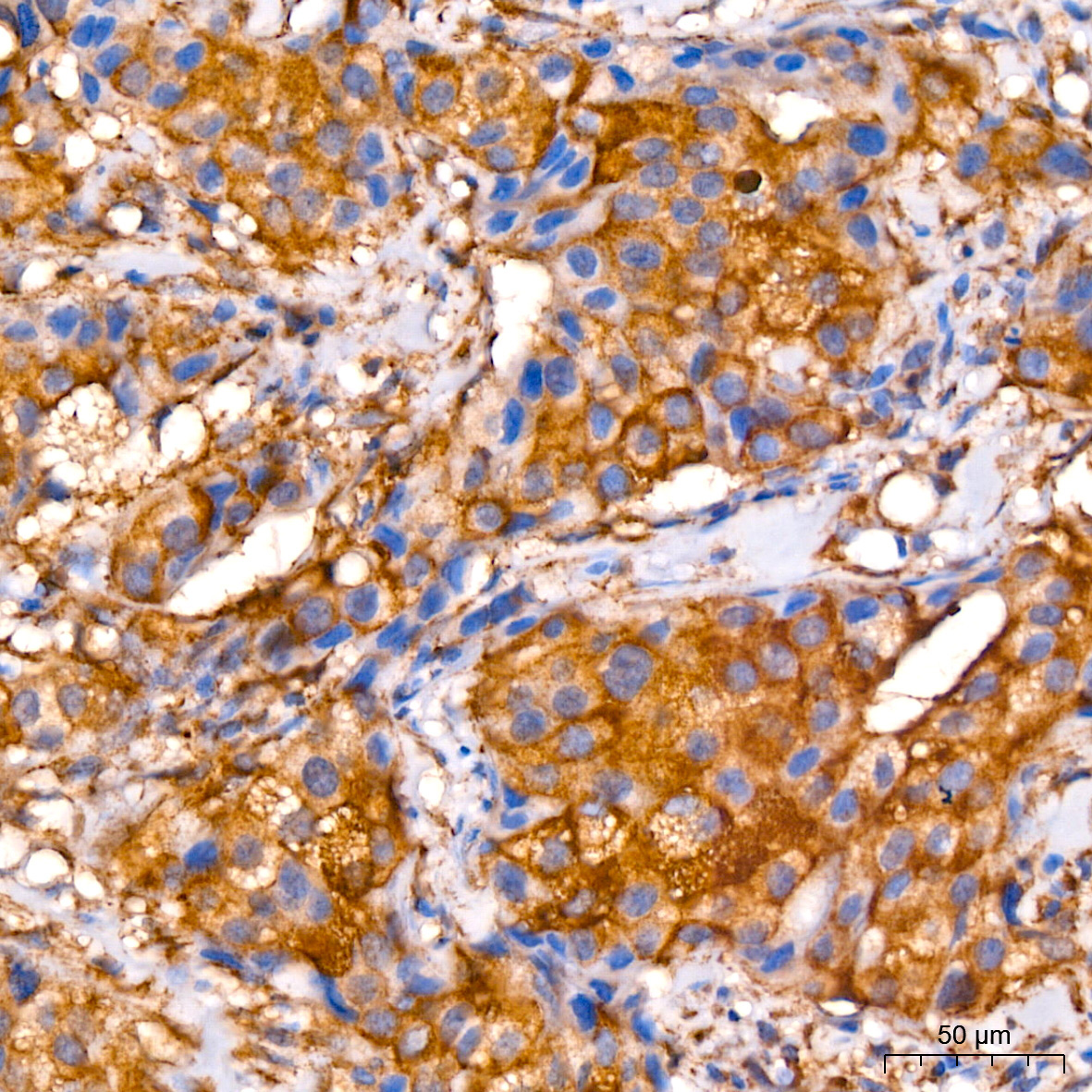 LRP/MVP Rabbit Monoclonal Antibody - Image 3