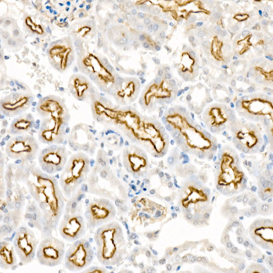 LRP2 Rabbit Polyclonal Antibody - Image 2