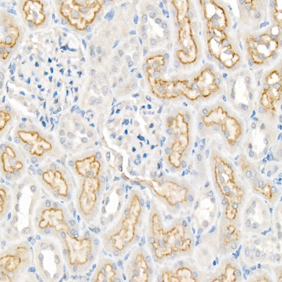 LRP2 Rabbit Polyclonal Antibody - Image 3