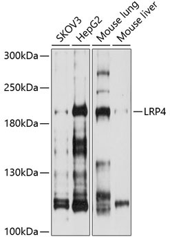 LRP4 Rabbit Polyclonal Antibody