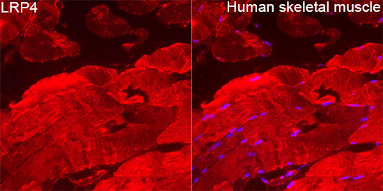 LRP4 Rabbit Polyclonal Antibody