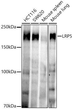LRP5 Rabbit Monoclonal Antibody