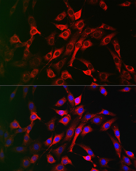 LRP5 Rabbit Polyclonal Antibody - Image 2