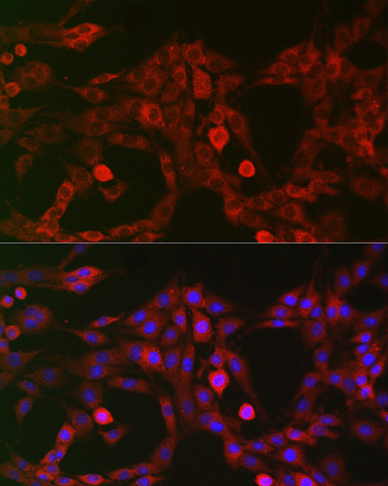 LRP5 Rabbit Polyclonal Antibody - Image 3