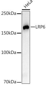 LRP6 Rabbit Monoclonal Antibody