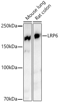 LRP6 Rabbit Monoclonal Antibody - Image 2