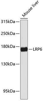LRP6 Rabbit Polyclonal Antibody