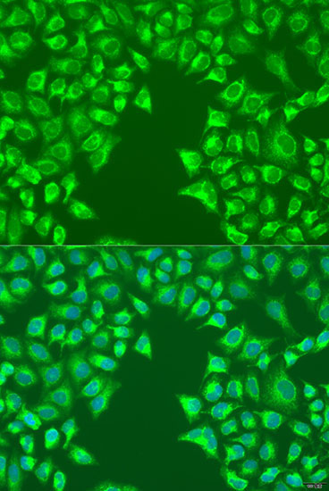 LRP6 Rabbit Polyclonal Antibody