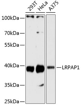 LRPAP1 Rabbit Polyclonal Antibody
