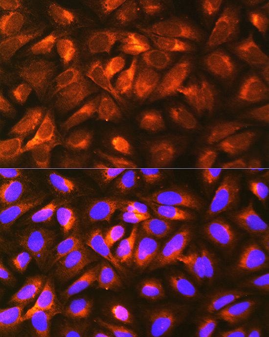 LRPAP1 Rabbit Polyclonal Antibody - Image 2