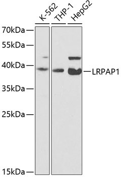 LRPAP1 Rabbit Polyclonal Antibody