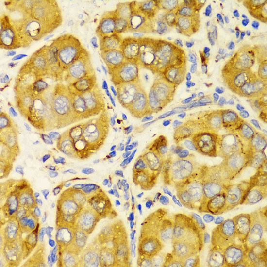 LRPAP1 Rabbit Polyclonal Antibody - Image 2