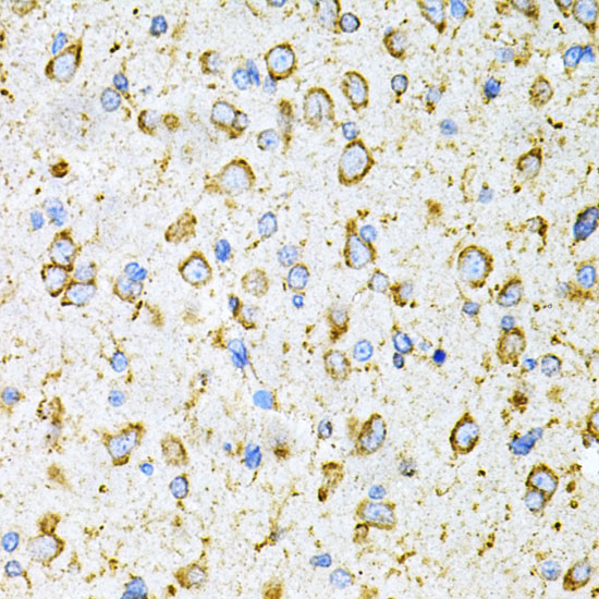 LRPAP1 Rabbit Polyclonal Antibody - Image 3