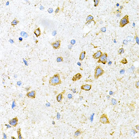 LRPAP1 Rabbit Polyclonal Antibody - Image 4