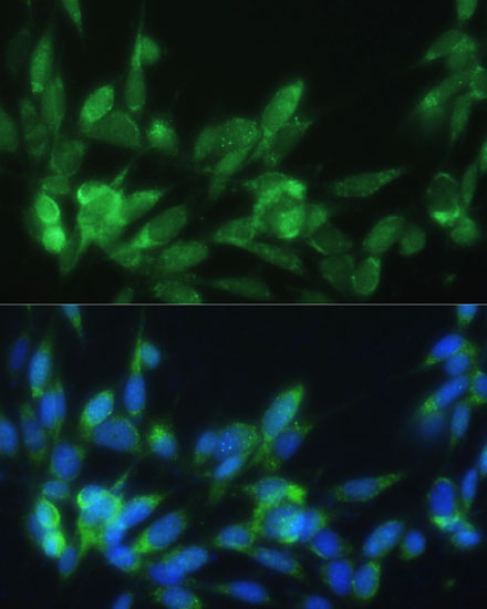 LRPAP1 Rabbit Polyclonal Antibody - Image 5