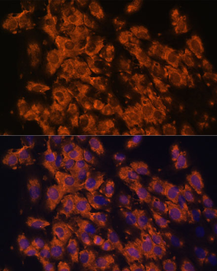 LRRC7 Rabbit Polyclonal Antibody - Image 2