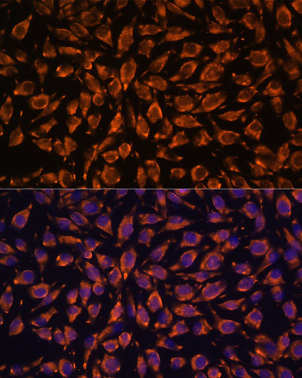 LRRC7 Rabbit Polyclonal Antibody - Image 3