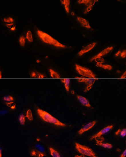 LRRC7 Rabbit Polyclonal Antibody - Image 4