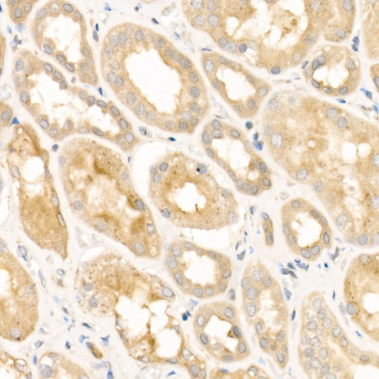 LRRK2 Rabbit Polyclonal Antibody - Image 2