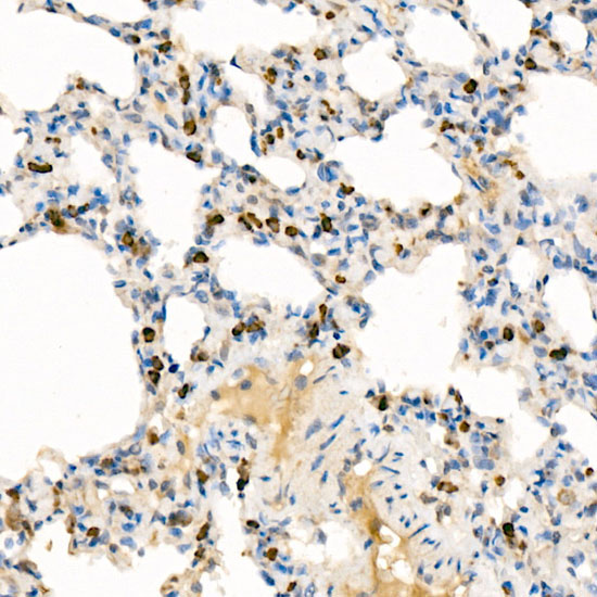 LRRK2 Rabbit Polyclonal Antibody - Image 3