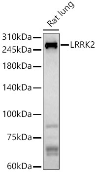 LRRK2 Rabbit Polyclonal Antibody