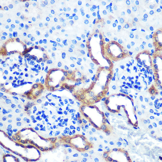 LRRK2 Rabbit Polyclonal Antibody - Image 2