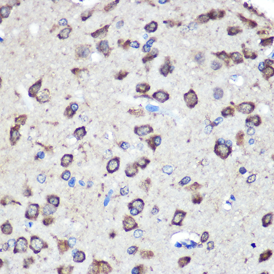 LRRK2 Rabbit Polyclonal Antibody - Image 3