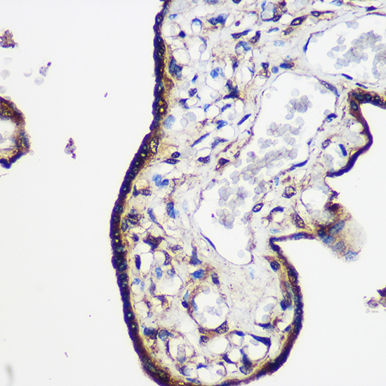 LRRK2 Rabbit Polyclonal Antibody - Image 4