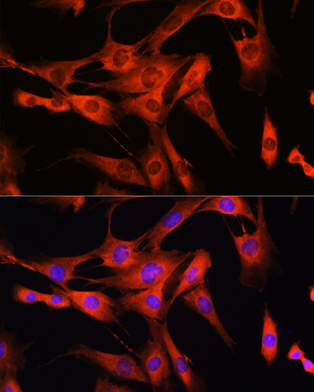 LRRK2 Rabbit Polyclonal Antibody - Image 5
