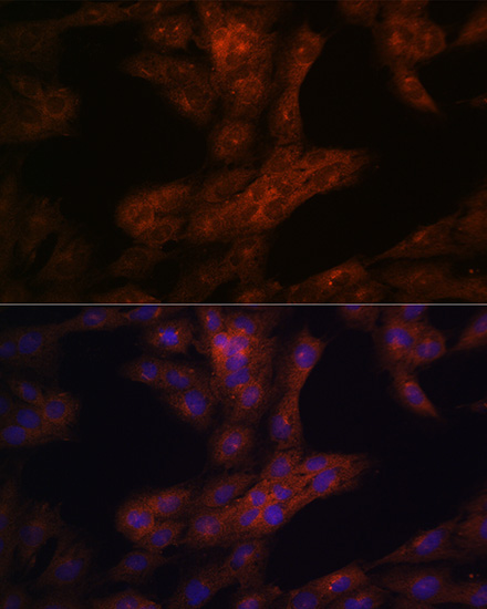 LRRK2 Rabbit Polyclonal Antibody - Image 6
