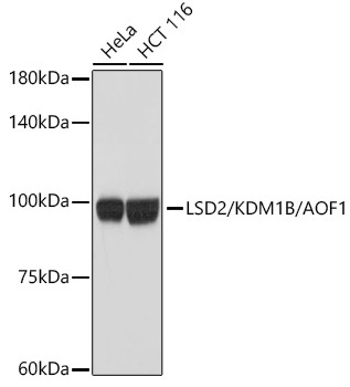 LSD2/KDM1B/AOF1 Rabbit Monoclonal Antibody