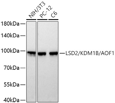 LSD2/KDM1B/AOF1 Rabbit Monoclonal Antibody - Image 2