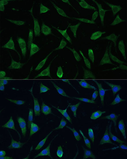 LSM14A Rabbit Polyclonal Antibody - Image 2