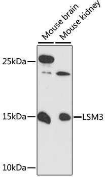 LSM3 Rabbit Polyclonal Antibody