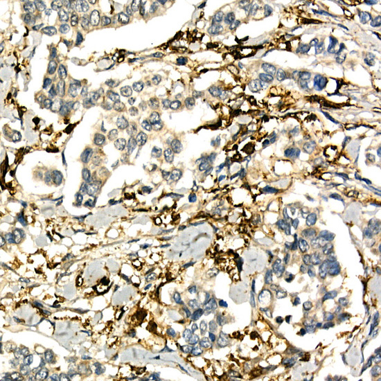 LTA Rabbit Polyclonal Antibody - Image 2