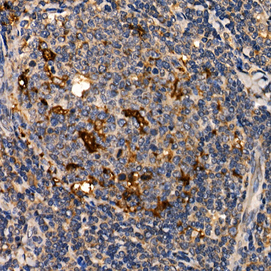 LTA Rabbit Polyclonal Antibody - Image 3
