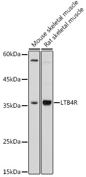 LTB4R Rabbit Polyclonal Antibody