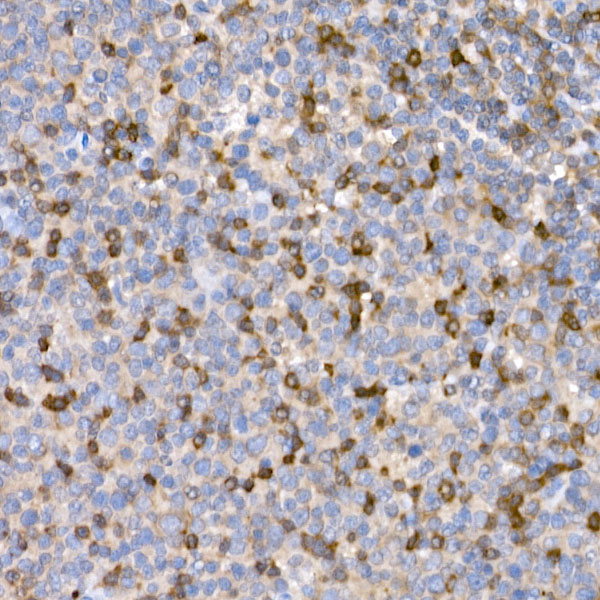 LTBR Rabbit Polyclonal Antibody - Image 3