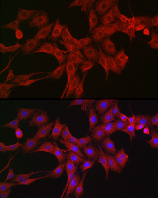 LTBR Rabbit Polyclonal Antibody - Image 4
