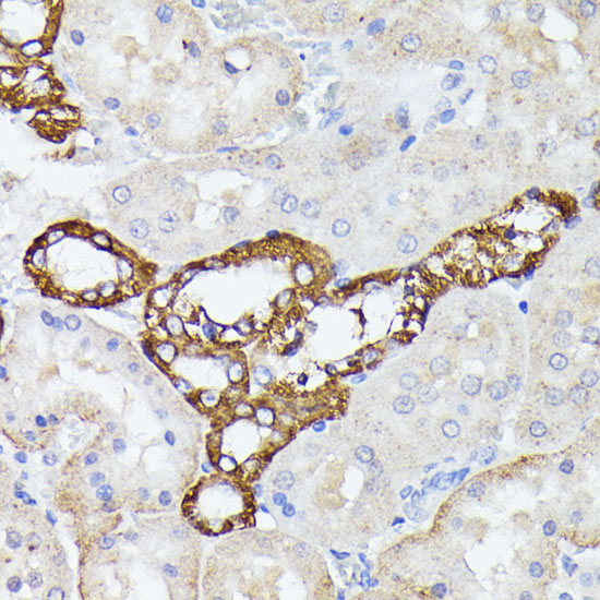 LTF Rabbit Polyclonal Antibody - Image 2