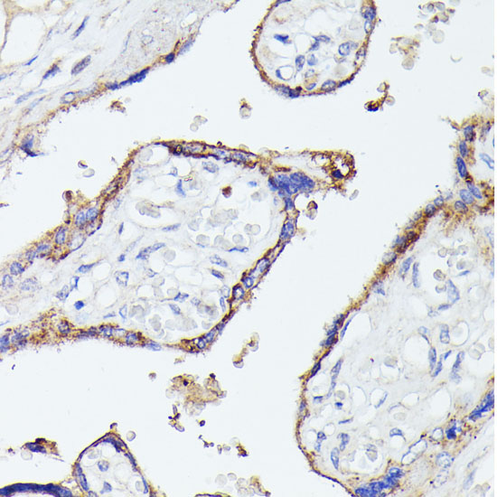 LTF Rabbit Polyclonal Antibody - Image 3