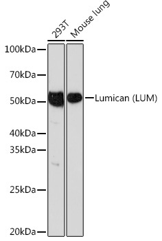 Lumican (LUM) Rabbit Monoclonal Antibody