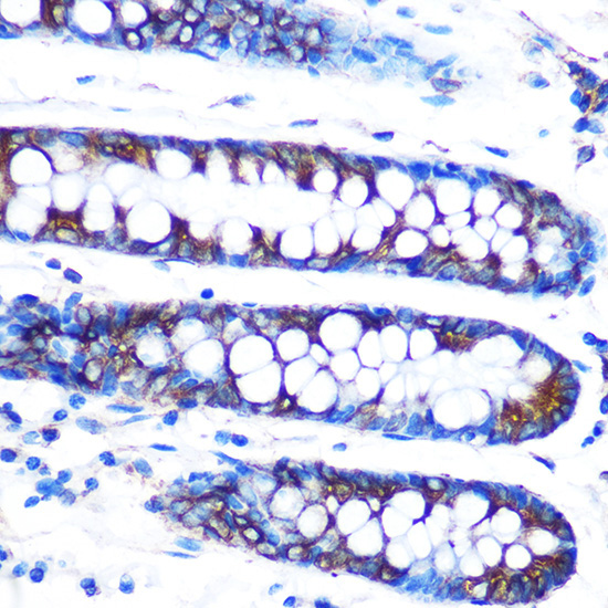 Lumican (LUM) Rabbit Monoclonal Antibody - Image 2